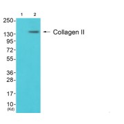 Western blot analysis of extracts from 3T3 cells (Lane 2), using COL2 Antibody. The lane on the left is treated with synthesized peptide.
