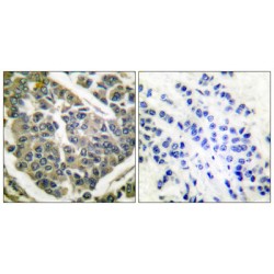 Collagen Type IV Alpha 1 (COL4A1) Antibody