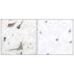 Prostaglandin G/H Synthase 1 (PTGS1) Antibody