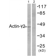 Western blot analysis of extracts from COLO205 cells, using Actin- gamma 2 antibody.