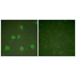 Cullin 1 (CUL1) Antibody