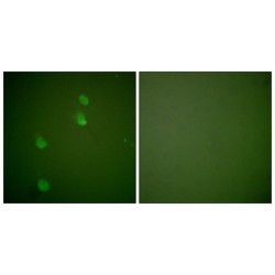 Cullin 2 (CUL2) Antibody