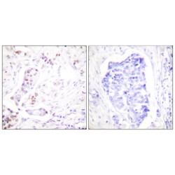 Cyclin A1 (CCNA1) Antibody