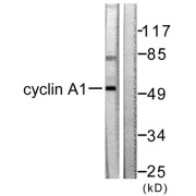 Western blot analysis of extracts from SKOV3 cells, using Cyclin A1 antibody (abx013053).