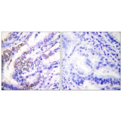 Cyclin E1 (CCNE1) Antibody