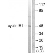 Western blot analysis of extracts from K562 cells, using Cyclin E1 antibody.
