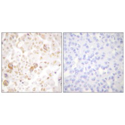 Cyclin F (CCNF) Antibody