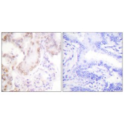 Cyclin G (CycG) Antibody