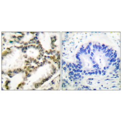 Protein DJ-1 (DJ-1) Antibody