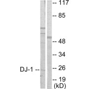 Western blot analysis of extracts from HuvEc cells, using DJ-1 antibody (abx013059).