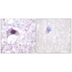 E2F Transcription Factor 6 (E2F6) Antibody