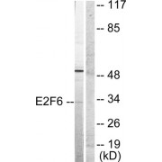 Western blot analysis of extracts from HepG2 cells, using E2F6 antibody (abx013065).
