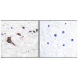 Endoplasmic Reticulum-Associated Amyloid Beta-Peptide-Binding Protein (ERAB) Antibody