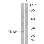 Western blot analysis of extracts from LOVO cells, using ERAB antibody.