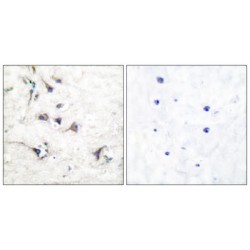Ezrin (EZR) Antibody