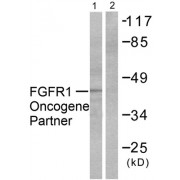 Western blot analysis of extracts from HepG2 cells, using FGFR1 Oncogene Partner antibody (abx013075).
