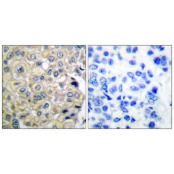 Fibroblast Growth Factor Receptor 3 (FGFR3) Antibody