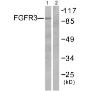 Western blot analysis of extracts from LOVO cells, using FGFR3 antibody.