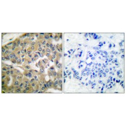 Fragile Histidine Triad (FHIT) Antibody