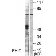 Western blot analysis of extracts from A549 cells, using FHIT antibody (abx013078).
