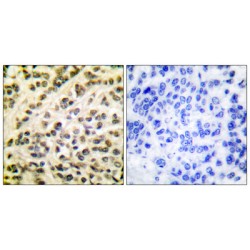 Friend Leukemia Virus Integration 1 (FLI1) Antibody