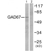 Western blot analysis of extracts from LOVO cells, using GAD67 antibody.