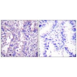 GAD1 / 2 Antibody