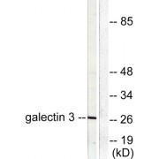 Western blot analysis of extracts from HeLa cells, using Galectin 3 antibody (abx013087).