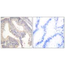 Gastrin (GAST) Antibody