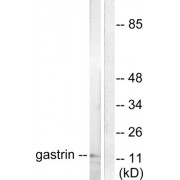 Western blot analysis of extracts from NIH/3T3 cells, using Gastrin antibody (abx013089).