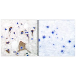 Glutamate Receptor 5 (GlUR5) Antibody