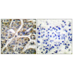 Granzyme B (GZMB) Antibody