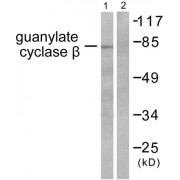 Western blot analysis of extracts from HuvEc cells, using Guanylate Cyclase beta antibody (abx013101).