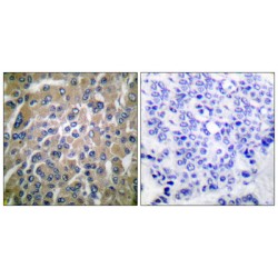 hCG beta Antibody
