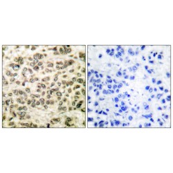 Histone Deacetylase 3 (HDAC3) Antibody