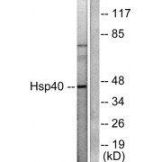 Western blot analysis of extracts from COLO205 cells, using HSP40 antibody (abx013112).