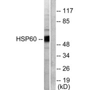 Western blot analysis of extracts from COLO205 cells, using HSP60 antibody (abx013113).