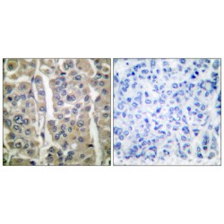 Involucrin (IVL) Antibody