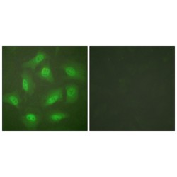 JAB1-Containing Signalosome Subunit 3 (JAB1) Antibody