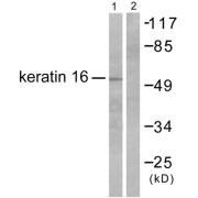 Western blot analysis of extracts from HepG2 cells, using Keratin 16 antibody (abx013120).