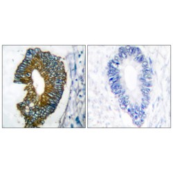 Keratin 18 (KRT18) Antibody
