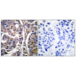 Keratin, Type I Cytoskeletal 20 (KRT20) Antibody