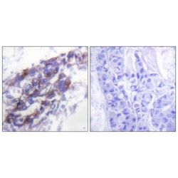 Keratin 8 (KRT8) Antibody