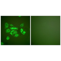 Keratin 10 (KRT10) Antibody