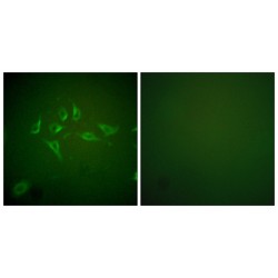 Nitric Oxide Synthase, Inducible (NOS2) Antibody