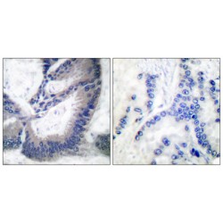 Nitric Oxide Synthase, Inducible (NOS2) Antibody