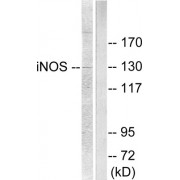Western blot analysis of extracts from NIH/3T3 cells, using NOS2 antibody (abx013130).