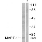 Western blot analysis of extracts from NIH/3T3 cells, using MART-1 antibody (abx013135).