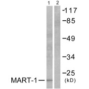 Western blot analysis of extracts from NIH/3T3 cells, using MART-1 antibody (abx013135).