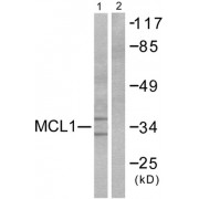 Western blot analysis of extracts from HuvEc cells, using MCL1 antibody (abx013136).
